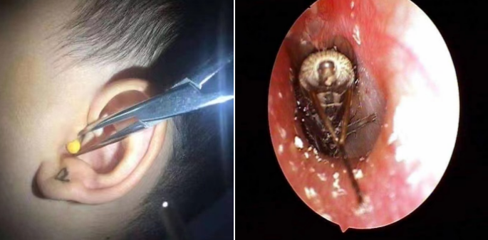 河南省直第三人民医院爱耳日活动侧记